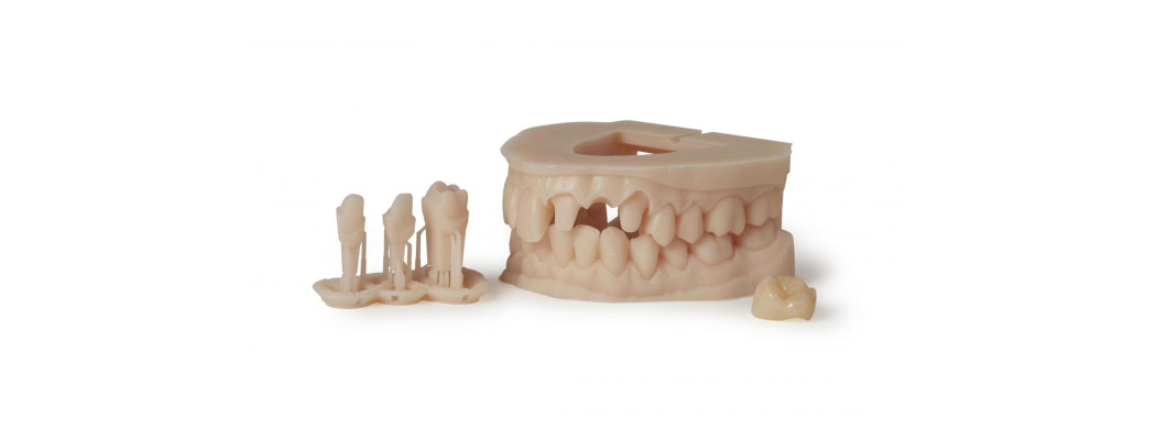 Formlabs Dental Model V3 prints